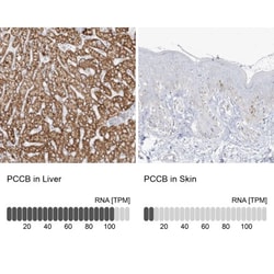 PCCB Antibody, Novus Biologicals 25 &mu;L; Unlabeled:Antibodies, Polyclonal